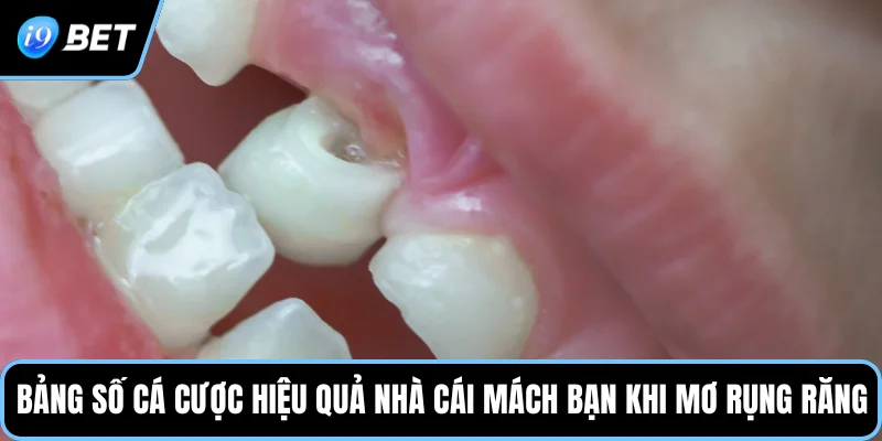Bảng số cá cược hiệu quả nhà cái mách bạn khi mơ rụng răng